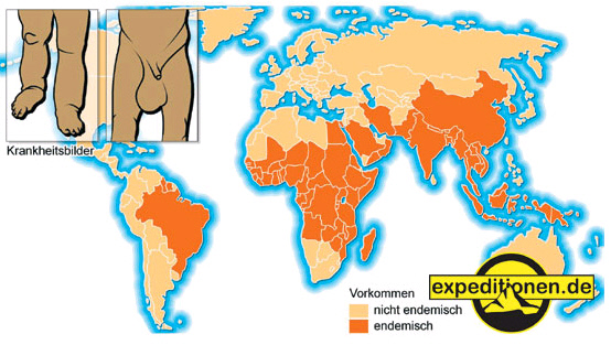 Elefantiasis Verbreitung